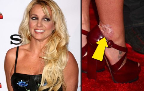 Trapas Britney Spears: Olezlé a krvavé paty!