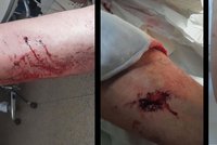 Neskutečná brutalita v Rousínově: Trhej! Poštval mladík bezdůvodně psa na muže