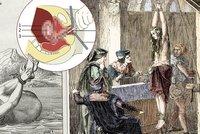 Co vám ve škole neřekli: Šokující historie potratů! Třiceticentimetrové jehly i mučení a popravy