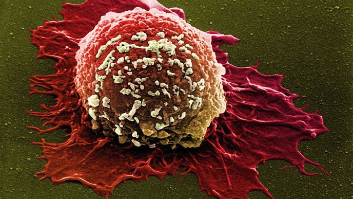 Rakovinná buňka