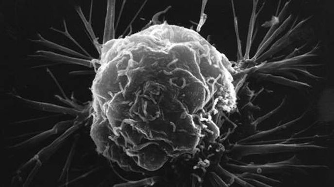 Nová terapie mění buňky rakoviny prsu na buňky tukové