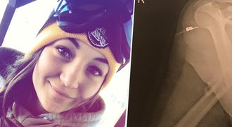 Těžké zranění snowboardcrossařky Burešové (23): V návratu ji podporuje i Krčmář!