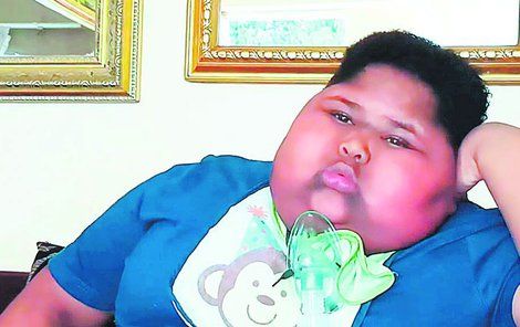  Desetiletý Caden Benjamin z Jihoafrické republiky trpí vzácnou poruchou, která způsobuje, že má pořád hlad. 