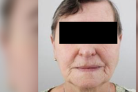 Marie (70) odešla z nemocnice ve Stodu: V ruce měla kanylu! Našli ji v pořádku