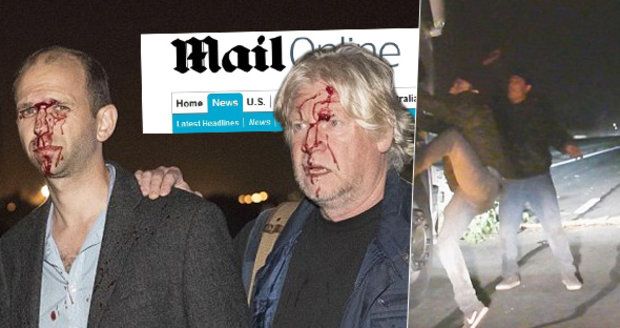 Novináři krvavě odnesli past migrantů. Brutalita uprchlíků v Calais stoupá