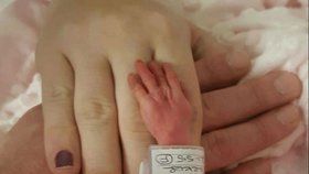 Rodiče zveřejnili dojemnou fotku, na které se loučí s dcerkou, která se narodila mrtvá.