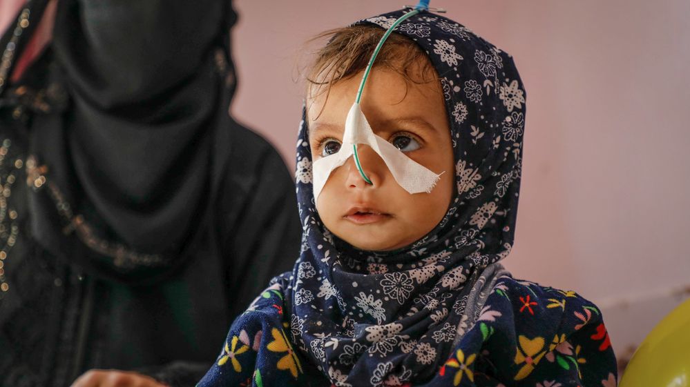 Malá Giham z Jemenu statečně bojuje o život již od narození.