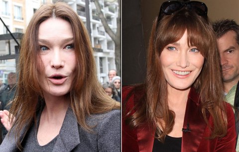 Botox už vyprchal! Carla Bruni z "kočičí ženy" znovu kočkou!