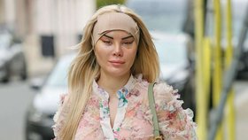 Modelka Carla Howe po operaci