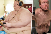 Kvůli své tloušťce Američan (38) ani nevylezl ze sprchy: Podařilo se mu zhubnout 260 kilogramů!
