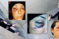 Brutální policista: Ženu hodil na beton, až jí praskla lebka!