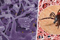 Evropu svírá strach ze zákeřného viru: Smrtnost je až 40 procent, přenáší ho klíšťata