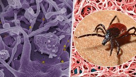 Evropu svírá strach ze zákeřného viru: Smrtnost je až 40 procent, přenáší ho klíšťata 
