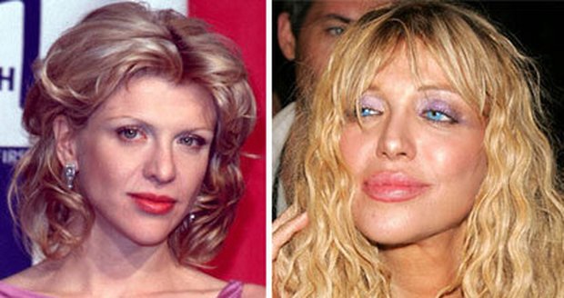 Zpackané plastiky: 7 celebrit, které vypadaly lépe před operací Vdova po Kurtu Cobainovi Courtney Love má za sebou hned několik vylepšení od plastických chirurgů. Lépe ale rozhodně nevypadá.