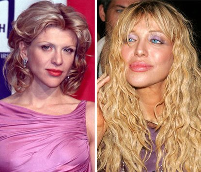 Vdova po Kurtu Cobainovi Courtney Love před a po plastikách.