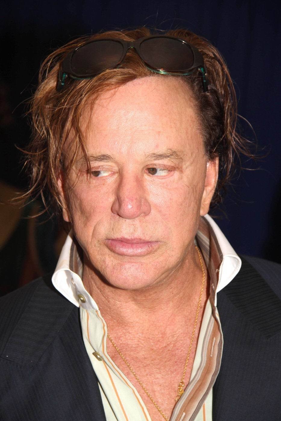 Mickey Rourke po plastikách