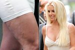 Britney Spears má také problémy s celulitidou.