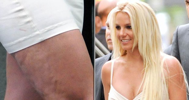 Britney Spears má také problémy s celulitidou.