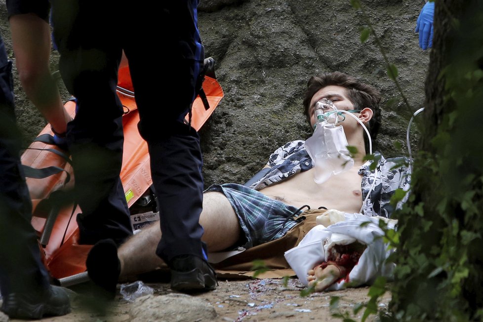 Výbuch podomácku vyrobené výbušniny v newyorském Central Parku vážně zranil mladíka