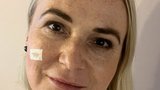 Ministryně obrany Černochová: Zákrok v nemocnici! Odstranili jí kožní nádor
