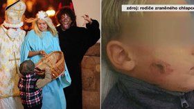 Čert napadl děti v Šumperku leptavou mastí: Útočníkům nebylo ani 15 let