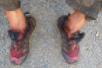 Otřesné foto: Bezdomovci z Plzně žrali červi nohy zaživa