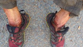 Otřesné foto: Bezdomovci z Plzně žrali červi nohy zaživa.