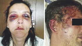 Dagmar a Miroslava napadla v České Lípě skupina Romů