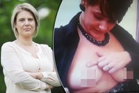 Žena (30) si nechala zvětšit prsa v Česku: Implantáty explodovaly a upadly jí bradavky