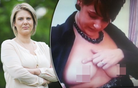 Žena (30) si nechala zvětšit prsa v Česku: Implantáty explodovaly a upadly jí bradavky