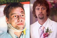 Vážná nehoda herce Jana Dolanského: O vlas unikl smrti