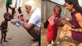 Charitativní pracovnice zachránila chlapce z ulice: Žaludek měl plný červů a umíral, teď se chystá poprvé do školky