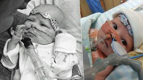 Chlapeček (5 týdnů) kvůli nemoci potřebuje nové srdce: Matka prosí všechny o pomoc