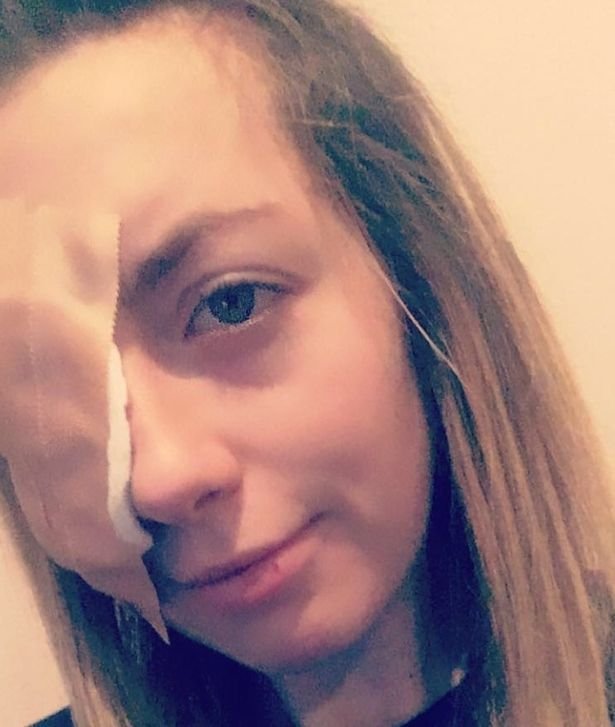 Chůva (24) oslepla na jedno oko: Komár jí vlétl do oka a zanesl tam infekci!