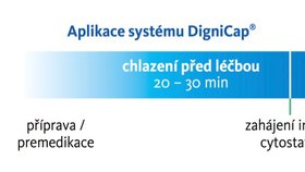 Na několika klinikách v Česku mají ženy možnost využít speciální „čepičku“ DigniCap, která chladí vlasové části pokožky hlavy.