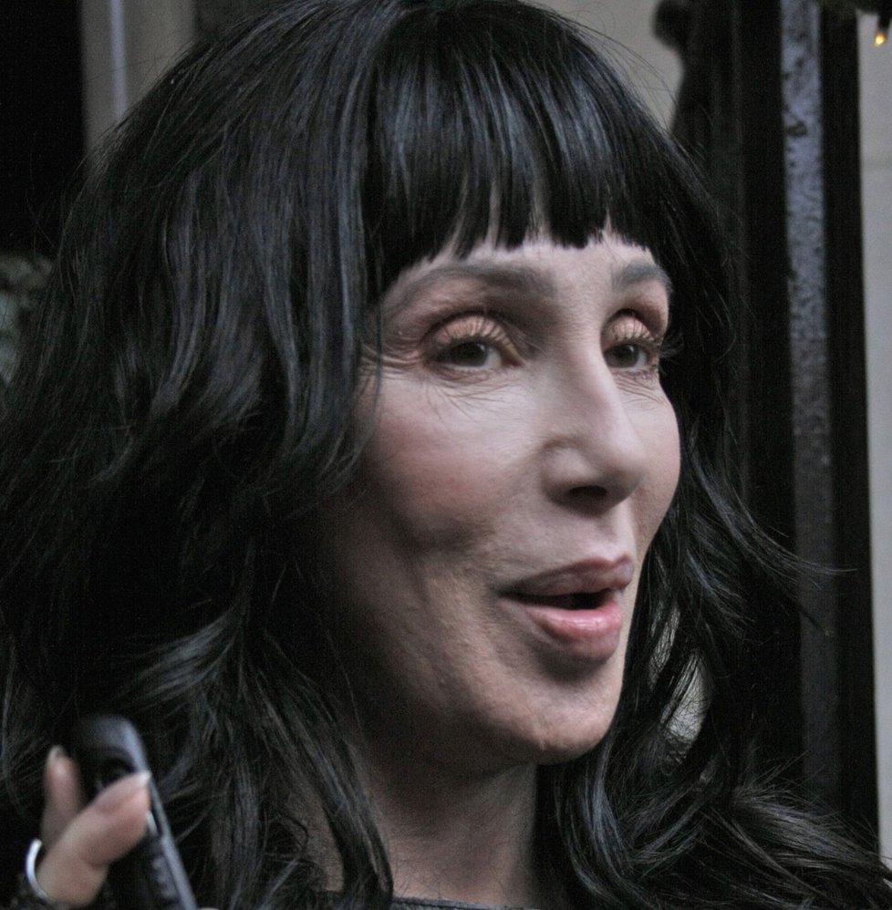 Cher má za sebou desítky plastických operací