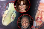 Cheryl Cole a Will.I.Am si z bouračky odnesli krvácející nosy.