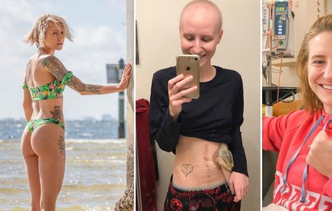 Mladá žena (†27) porazila rakovinu, ale po pár letech se jí vrátila: Bojovala až do hořkého konce