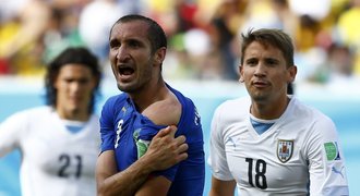 Pokousaný Chiellini soucítí se Suárezem: Trest je přehnaný!