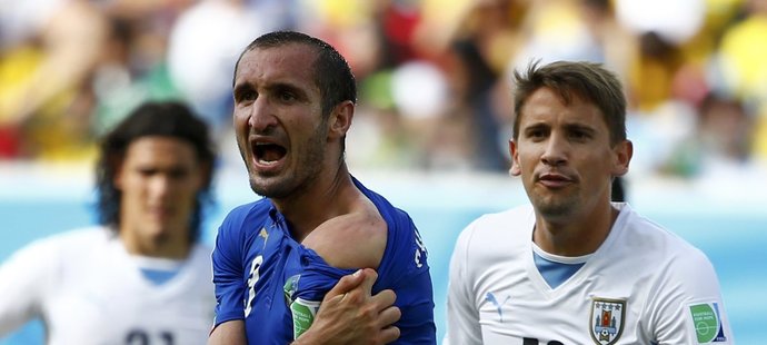Důkaz! Italský obránce Chiellini ukazuje otisk zubů po útoku Luise Suáreze.