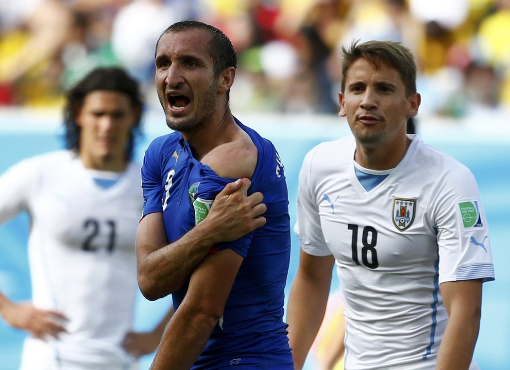 Důkaz! Italský obránce Chiellini ukazuje otisk zubů po útoku Luise Suáreze.