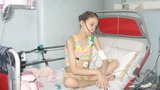 Chilská dívka, která žádala o eutanazii, podlehla smrtelné nemoci
