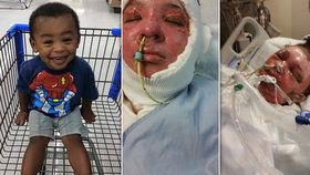 2letý hrdina: Chlapec zachránil svou matku a sestru před plameny, sám zemřel
