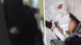 Brutální týrání měsíčního chlapce v Brně: Třikrát zlomená noha a popáleniny v obličeji!