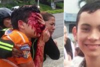 Hrůza ve Venezuele: Chlapci (16) policie na protestu vypálila 52 broků do obličeje! Mladík oslepl