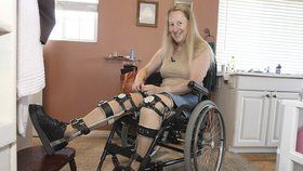 Chloe Jennings-White zatím působí jako neoficiální mluvčí "transhandicapovaných" a pokaždé, když sedne do auta, touží po tom, aby měla nehodu, při které přijde o nohy.