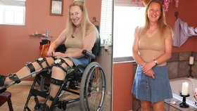 Chloe (58) nejraději tráví čas na kolečkovém křesle, i když je zcela zdravá