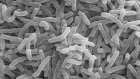 Bakterie vibrio cholerae se mrštně pohybují díky bičíku.