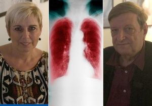Monika (58) a Jiří (68) mají plicní chorobu