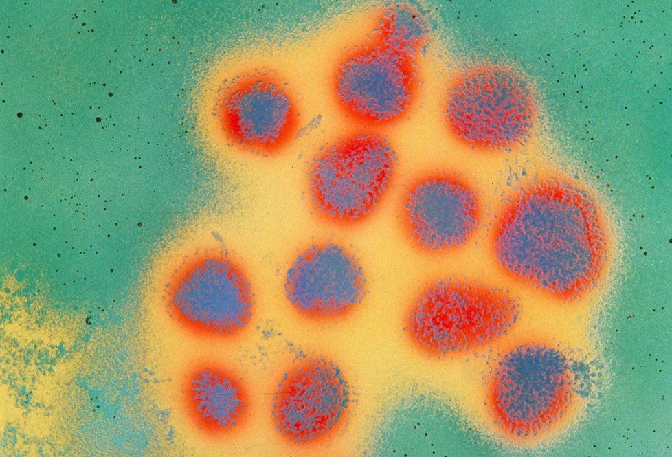 Chřipka je virové onemocnění, na které antibiotika nezabírají